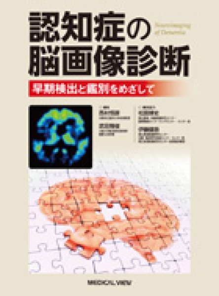 画像1: 認知症の脳画像診断 早期検出と鑑別をめざして (1)