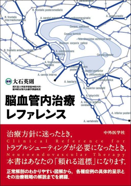 画像1: 脳血管内治療レファレンス (1)