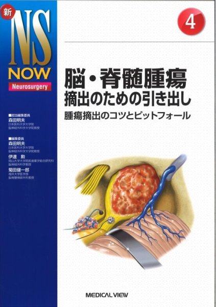 画像1: 【新NS NOW 4】脳・脊髄腫瘍摘出のための引き出し (1)