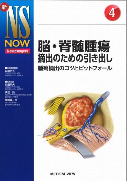 画像1: 《電子書籍.m3.com》【新NS NOW 4】脳・脊髄腫瘍摘出のための引き出し (1)