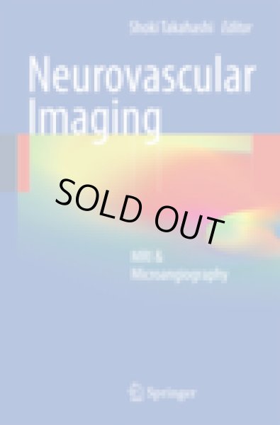 画像1: Neurovascular Imaging : MRI & Microangiography (1)