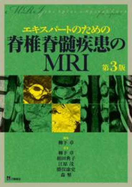 脊椎脊髄ジャーナル 2012年 10月号 [雑誌]