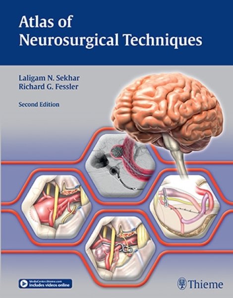 画像1: Atlas of Neurosurgical Techniques: Brain,2nd.2vols. (1)