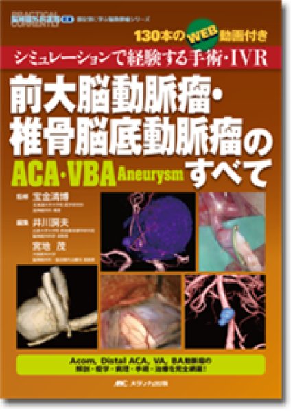 画像1: 前大脳動脈瘤・椎骨脳底動脈瘤（ACA・VBA Aneurysm）のすべて  (1)