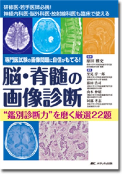 画像1: 脳・脊髄の画像診断 “鑑別診断力”を磨く厳選22題  (1)