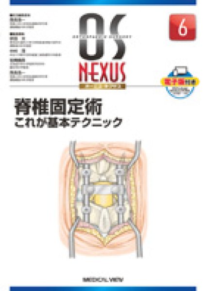 画像1: OS NEXUS（電子版付き） 6 脊椎固定術 これが基本テクニック (1)