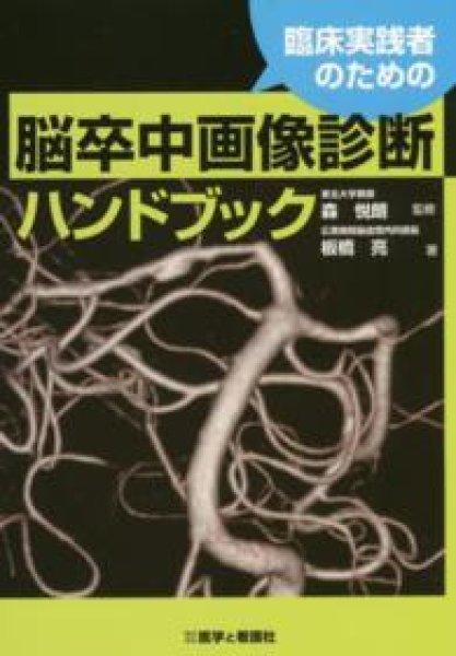 画像1: 臨床実践者のための脳卒中画像診断ハンドブック (1)