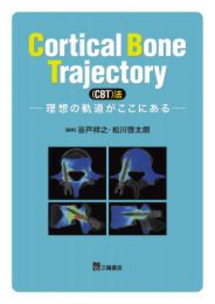 画像1: Cortical Bone Trajectory(CBT)法―理想の軌道がここにある (1)