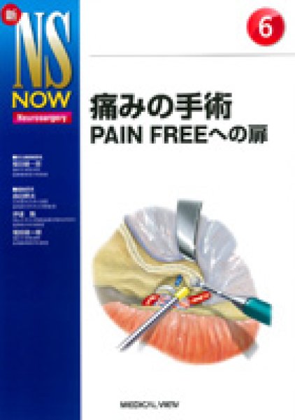 画像1: 【新NS NOW 6】痛みの手術 PAIN FREEへの扉 (1)