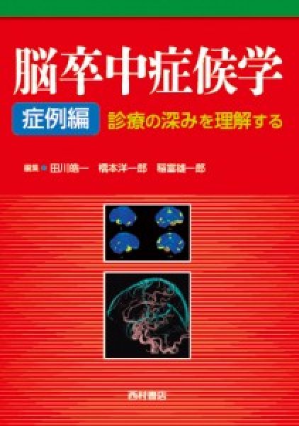 画像1: 脳卒中症候学【症例編】-診療の深みを理解する- (1)