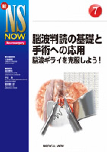 画像1: 【新NS NOW 7】脳波判読の基礎と手術への応用 (1)