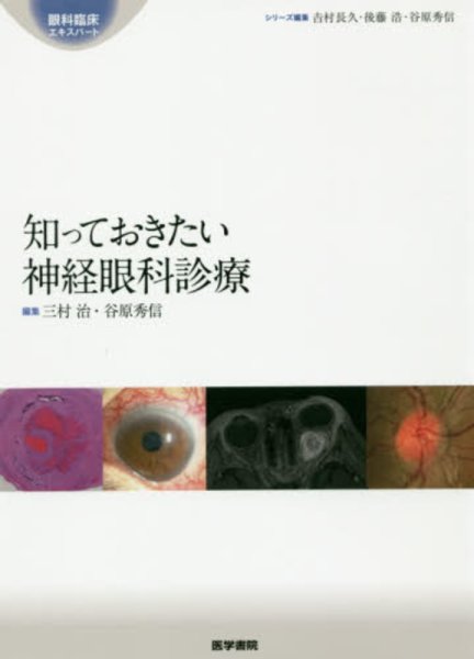 画像1: 知っておきたい神経眼科診療　[眼科臨床エキスパート] (1)
