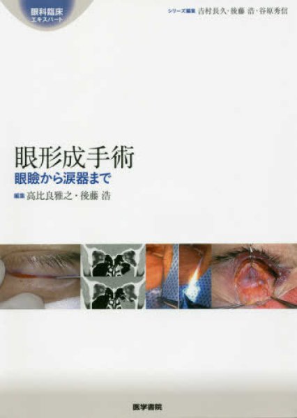画像1: 眼形成手術　[眼科臨床エキスパート] (1)