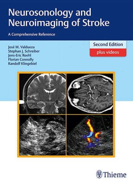 画像1: Neurosonology and Neuroimaging of Stroke: A Comprehensive Reference,2nd ed. (1)