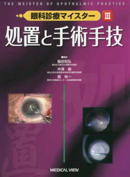画像1: 眼科診療マイスター II　処置と手術手技 (1)