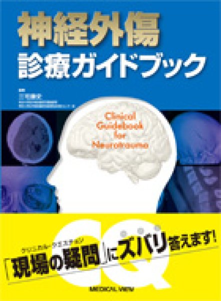 画像1: 神経外傷 診療ガイドブック (1)