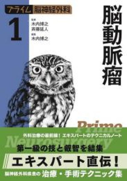 画像1: 【プライム脳神経外科 1】 脳動脈瘤 (1)