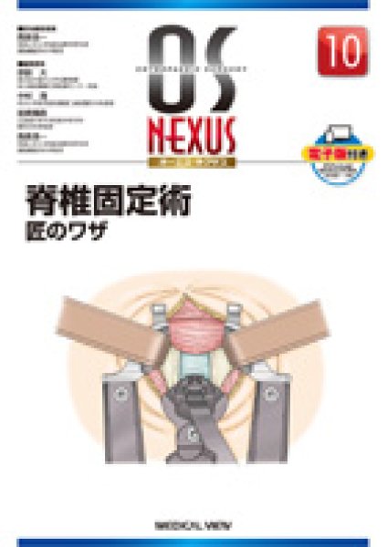 画像1: OS NEXUS（電子版付き） 10 脊椎固定術　匠のワザ (1)