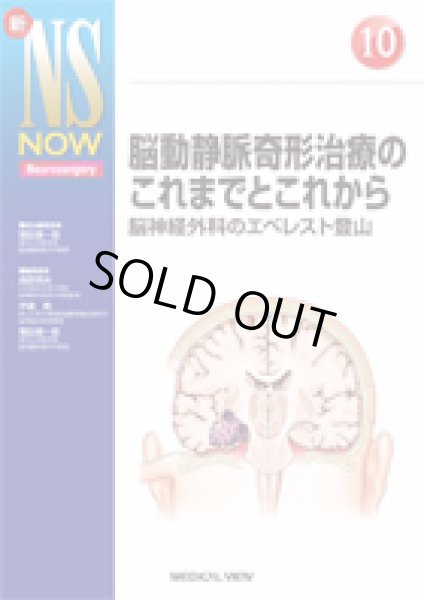 画像1: 【新NS NOW 10】脳動静脈奇形治療のこれまでとこれから (1)
