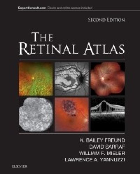 画像1: The Retinal Atlas 2nd Edition (1)