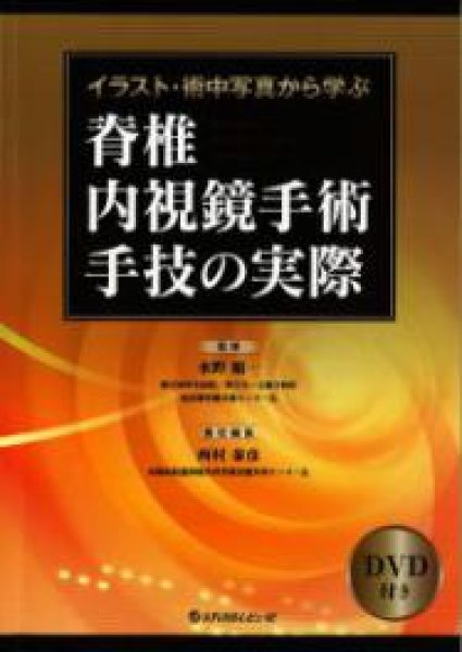 画像1: イラスト・術中写真から学ぶ脊椎内視鏡手術手技の実際 (1)