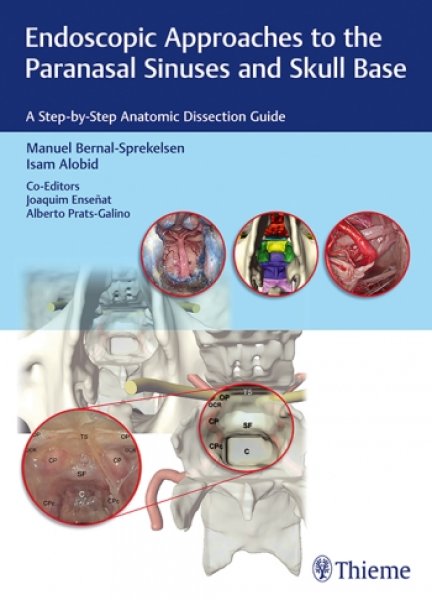 画像1: Endoscopic Approaches to the Paranasal Sinuses and Skull Base: A Step-by-Step Anatomic Dissection Guide (1)