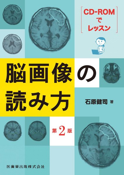 画像1: CD-ROMでレッスン 脳画像の読み方 第2版  (1)