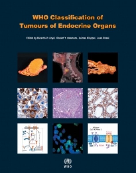画像1: WHO Classification of Tumours of Endocrine Organs [WHO/IARC Classification of Tumours, 4th Edition, Volume 10] (1)