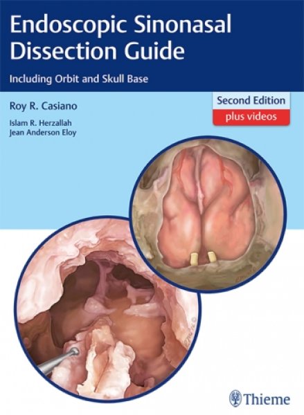 画像1: Endoscopic Sinonasal Dissection Guide Including Orbit and Skull Base,2nd. (1)