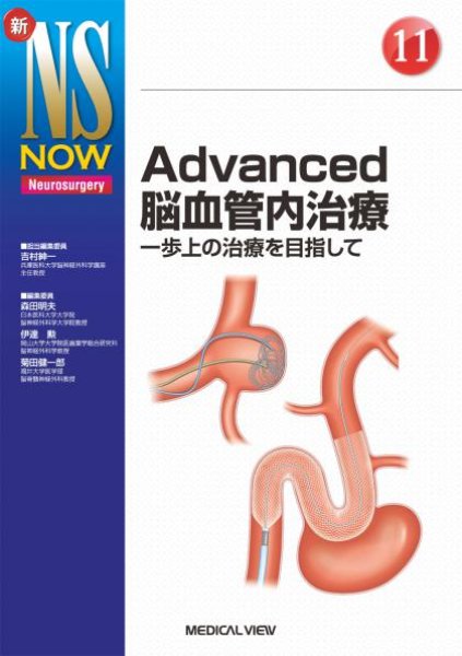 画像1: 【新NS NOW 11】Advanced脳血管内治療 (1)