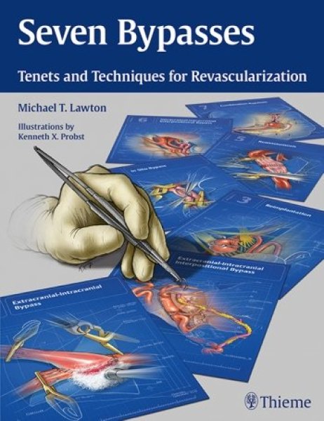画像1: Seven Bypasses: Tenets and Techniques for Revascularization (1)