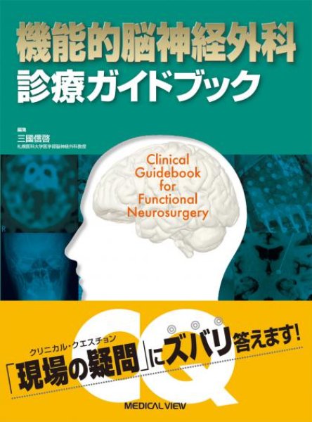 画像1: 機能的脳神経外科 診療ガイドブック (1)