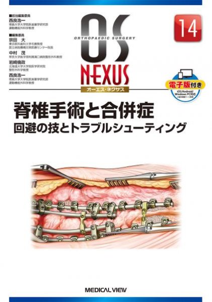 画像1: OS NEXUS（電子版付き） 14 脊椎手術と合併症 回避の技とトラブルシューティング (1)