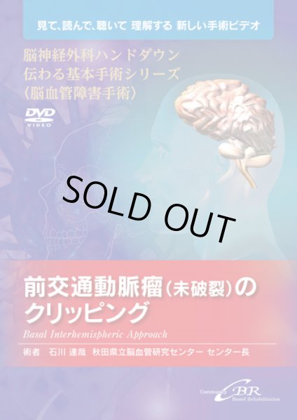 画像1: 【DVD】 脳神経外科ハンドダウン伝わる基本手術シリーズ〈脳血管障害手術〉　前交通動脈瘤（未破裂）のクリッピング―Basal Interhemispheric ApproachBasal (1)