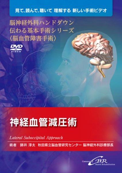 画像1: 【DVD】 脳神経外科ハンドダウン伝わる基本手術シリーズ〈脳血管障害手術〉　神経血管減圧術―Lateral Suboccipital Approach (1)