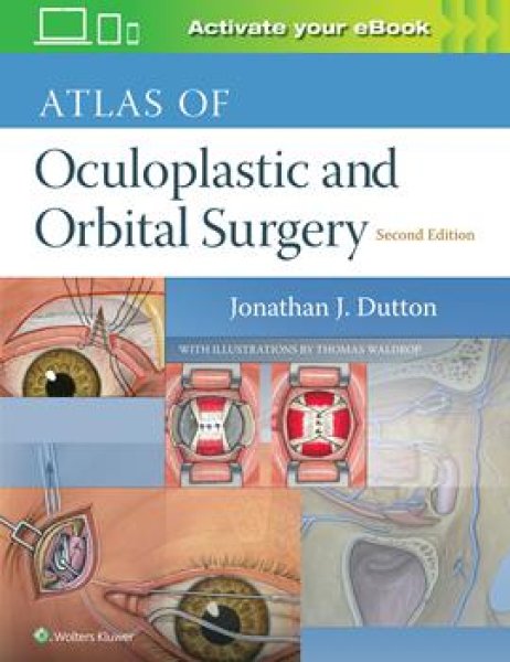 画像1: Atlas of Oculoplastic & Orbital Surgery, 2nd ed. (1)