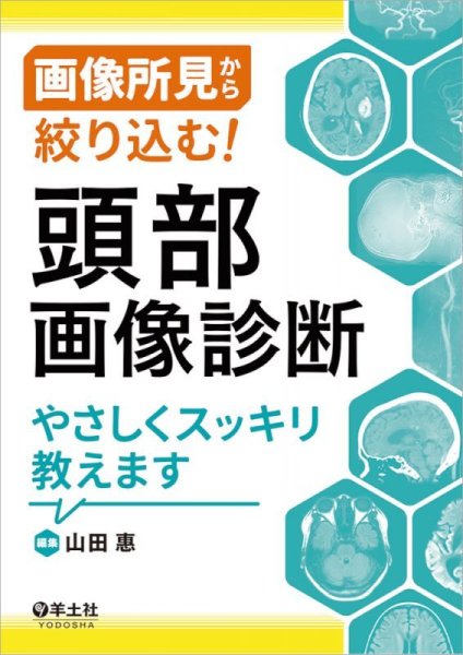 画像1: 画像所見から絞り込む！頭部画像診断やさしくスッキリ教えます (1)