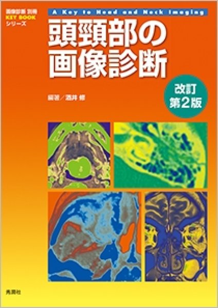 画像1: 頭頸部の画像診断　改訂第2版 （画像診断別冊KEY BOOKシリーズ ） (1)