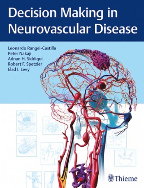 画像1: Decision Making in Neurovascular Disease (1)