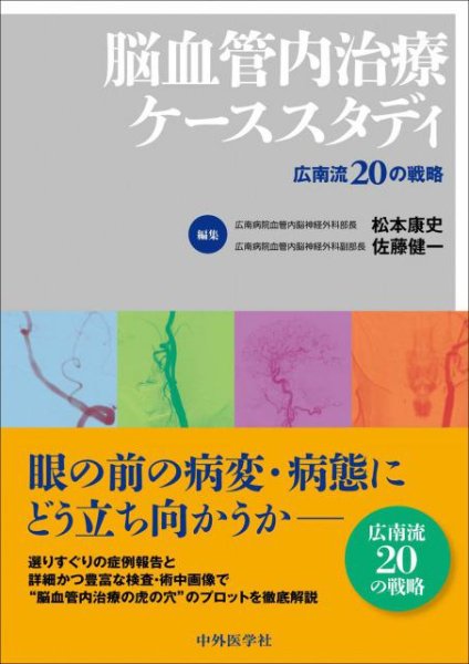 画像1: 脳血管内治療ケーススタディ 広南流20の戦略 (1)