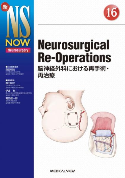 画像1: 【新NS NOW 16】 Neurosurgical Re-Operations 脳神経外科における再手術・再治療 (1)