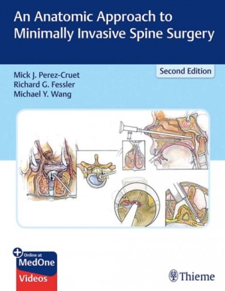 画像1: An Anatomic Approach to Minimally Invasive Spine Surgery.2nd. (1)