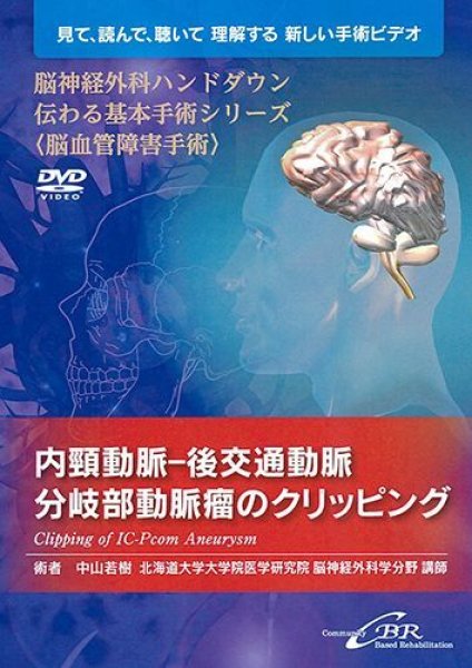 画像1: 【DVD】 脳神経外科ハンドダウン伝わる基本手術シリーズ〈脳血管障害手術〉　内頸動脈－後交通動脈分岐部動脈瘤のクリッピング―Clipping of IC-Pcom Aneurysm (1)
