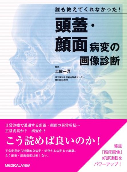 画像1: 誰も教えてくれなかった！ 頭蓋・顔面病変の画像診断 (1)