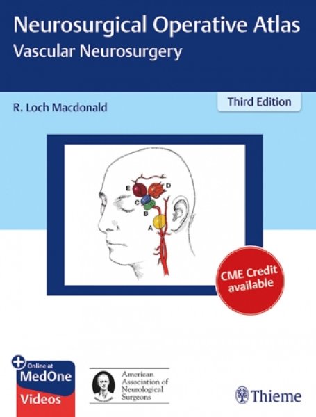 画像1: Neurosurgical Operative Atlas: Vascular Neurosurgery,3rd. (1)