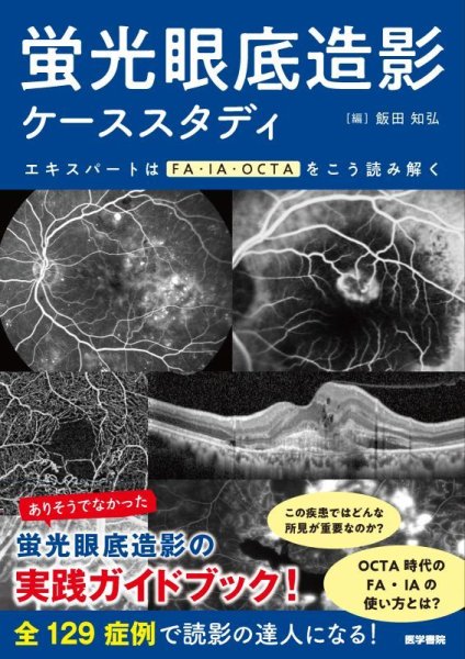 画像1: 蛍光眼底造影ケーススタディ　エキスパートはFA・IA・OCTAをこう読み解く (1)