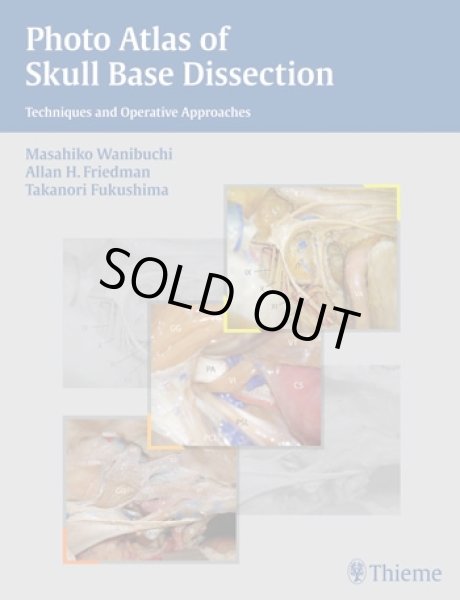 画像1: Photo Atlas of Skull Base Dissection -Techniques and Operative Approaches (1)
