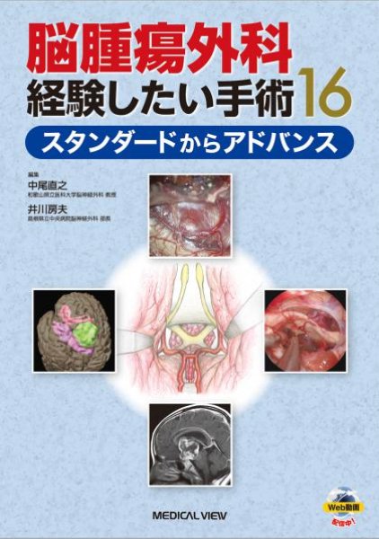 画像1: 脳腫瘍外科 経験したい手術16 スタンダードからアドバンス (1)