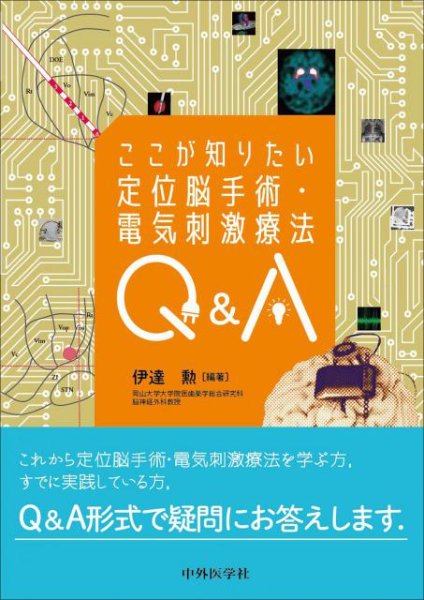 画像1: ここが知りたい定位脳手術・電気刺激療法Q&A (1)