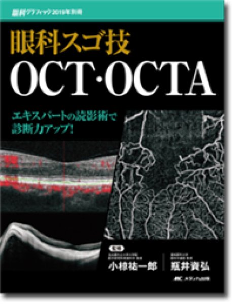 画像1: 眼科スゴ技 OCT・OCTA (1)